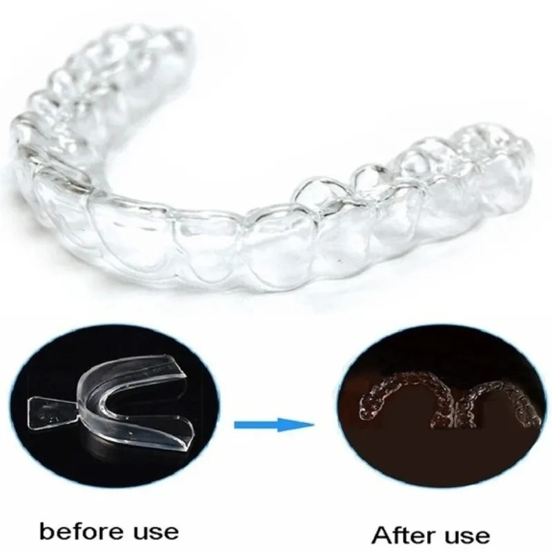 1/3/6pairs Silicone Mouth Guar - Teeth Whitening With Braces recensie en prijs