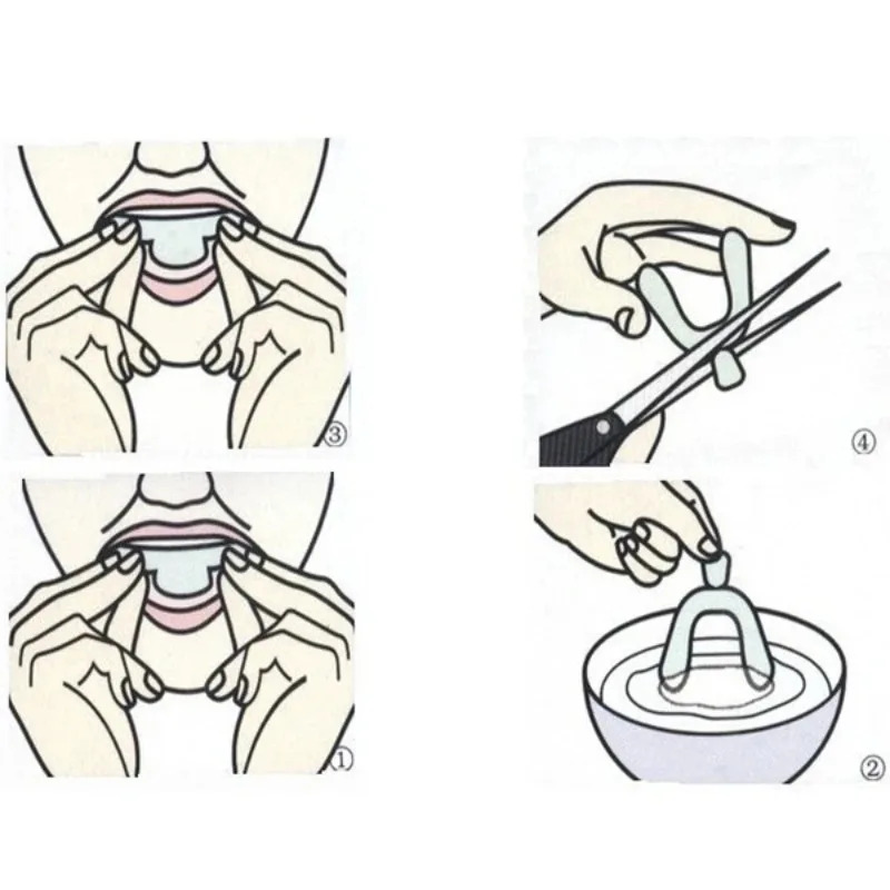 1/3/6pairs Silicone Mouth Guar - Teeth Whitening With Braces recensie en prijs