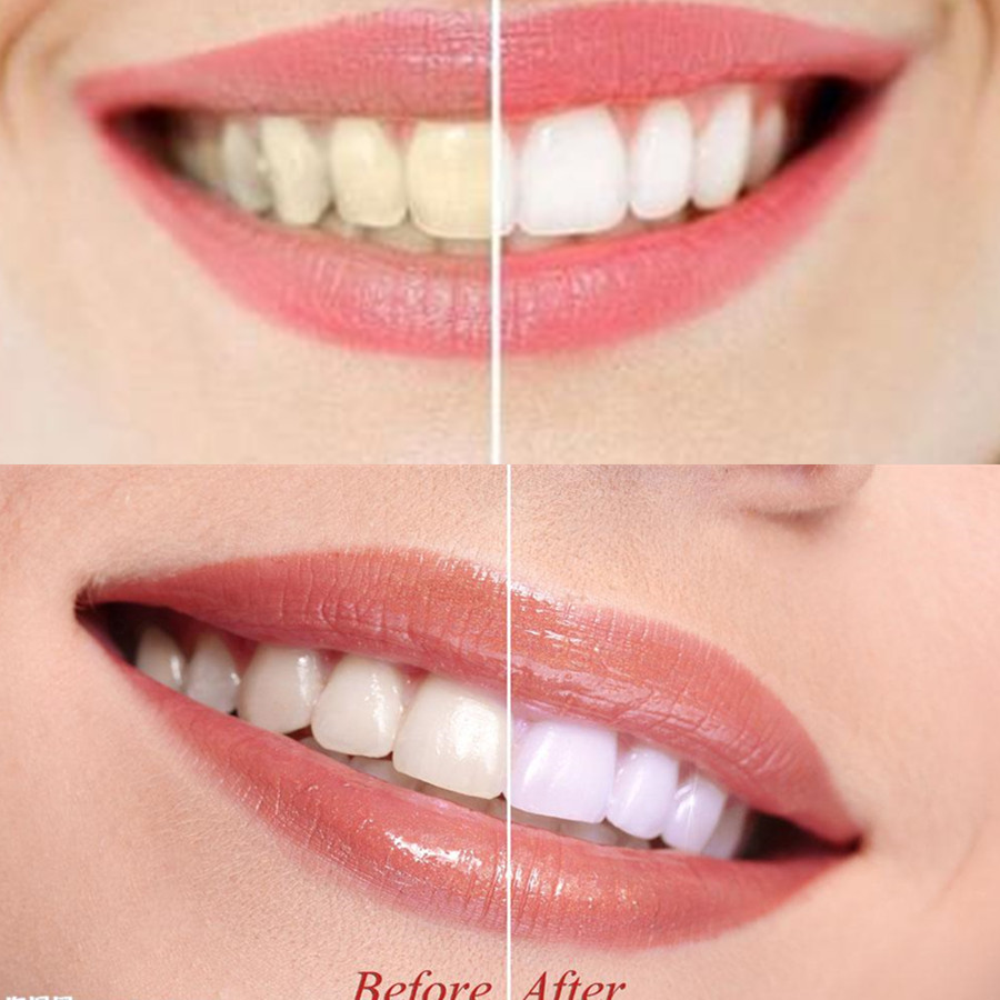 Bamboo Charcoal Teeth Tooth De - Teeth Whitening Co recensie en prijs
