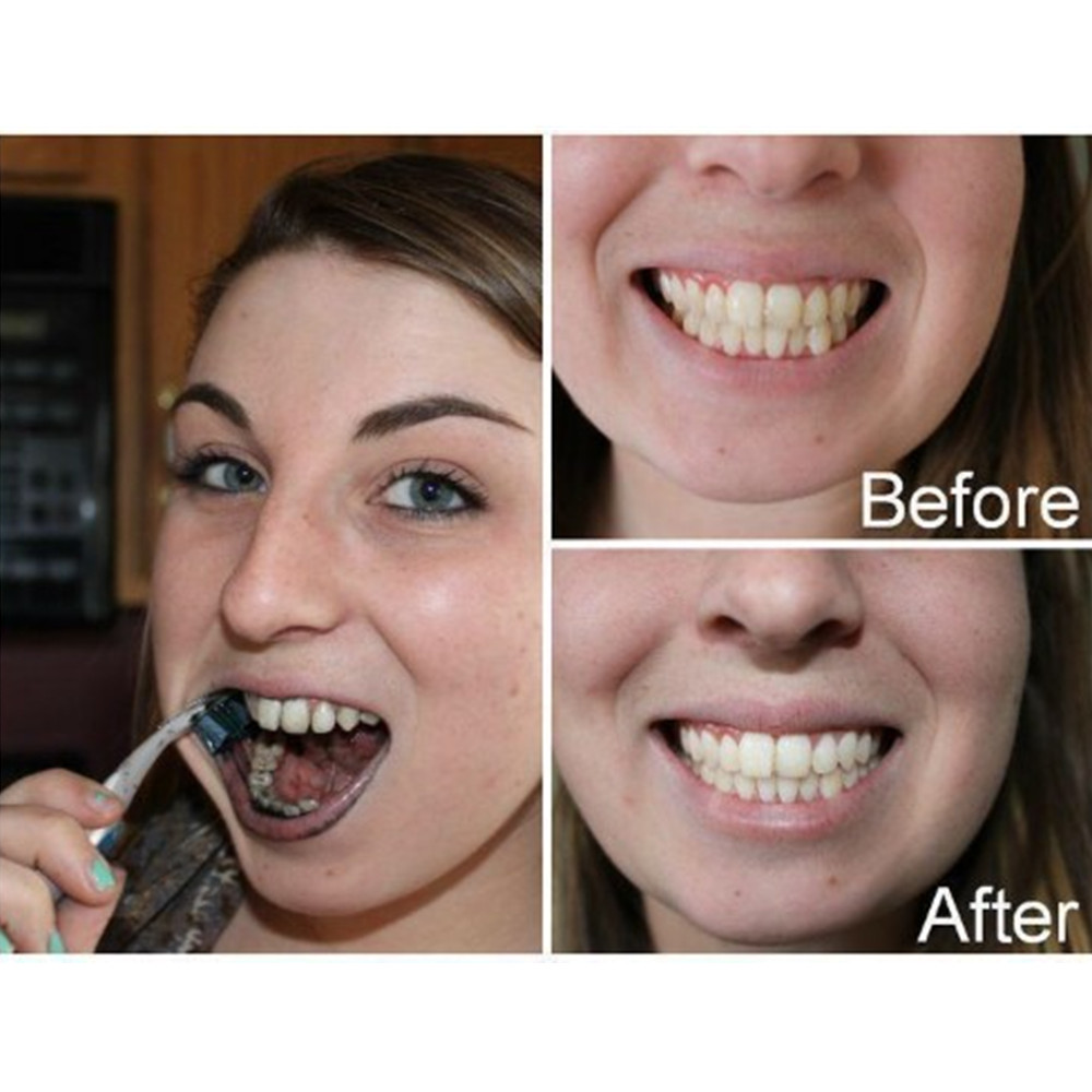 Bamboo Charcoal Teeth Tooth De - Teeth Whitening Co recensie en prijs