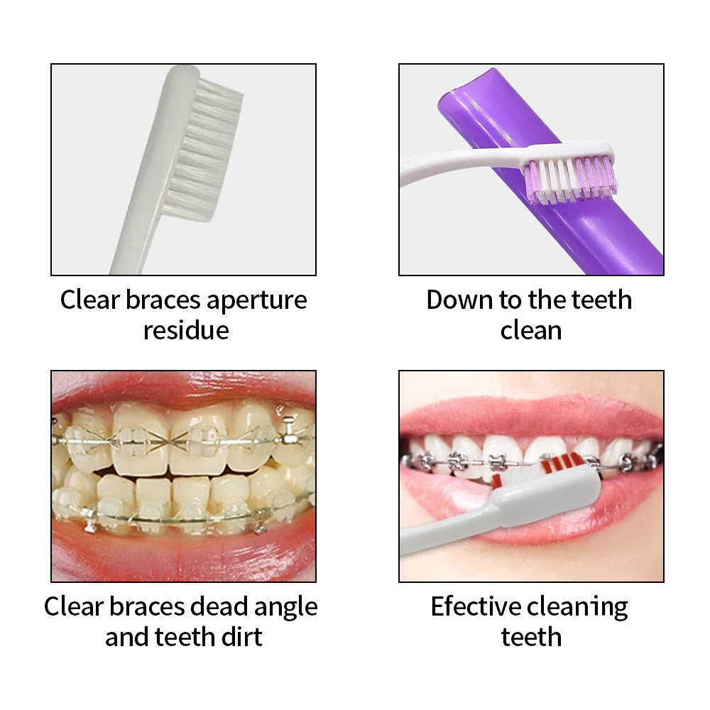 8Pcs/set Orthodontic Dental Ca - Teeth Whitening With Braces recensie en prijs