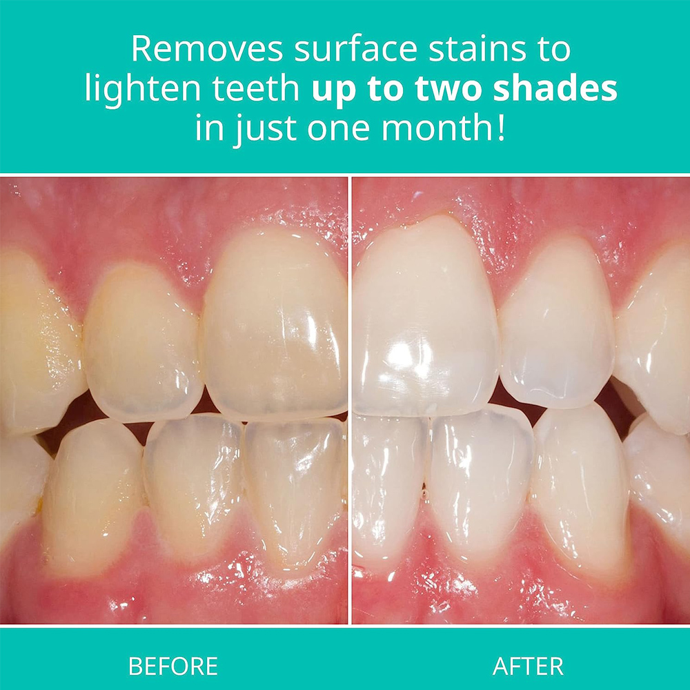 Opalescence Whitening Toothpas - Teeth Whitening Gel Opalescence recensie en prijs