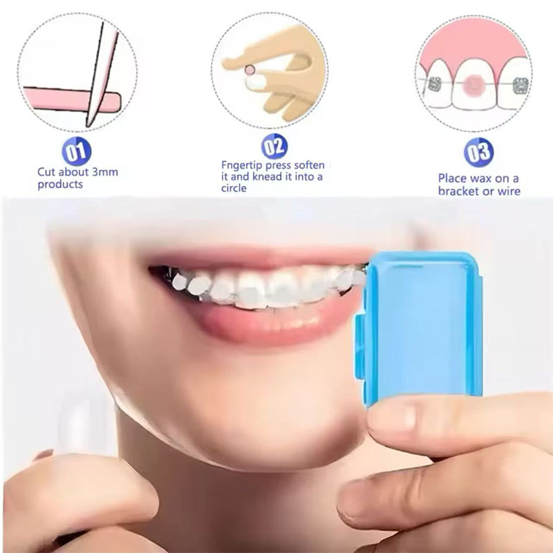 1set Orthodontic Dental Oral C - Teeth Whitening With Braces recensie en prijs