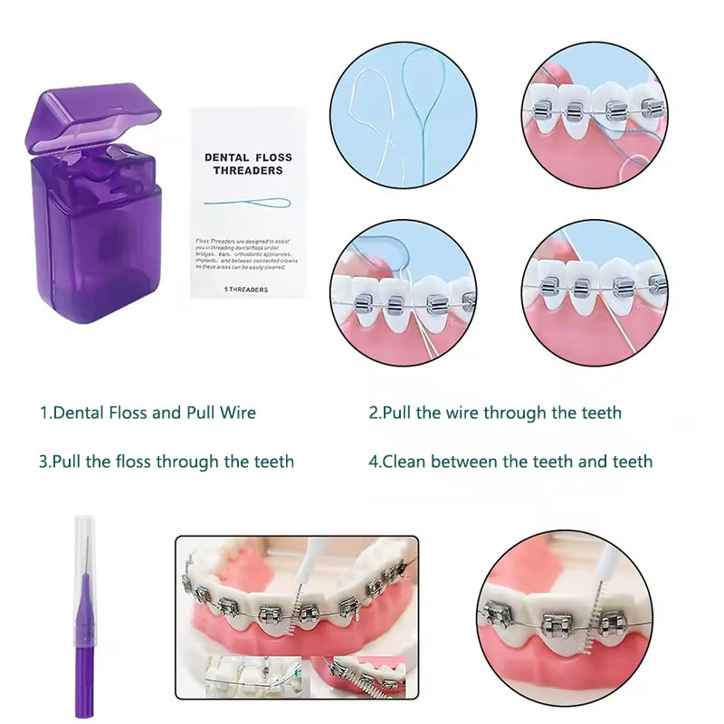 1set Orthodontic Dental Oral C - Teeth Whitening With Braces recensie en prijs