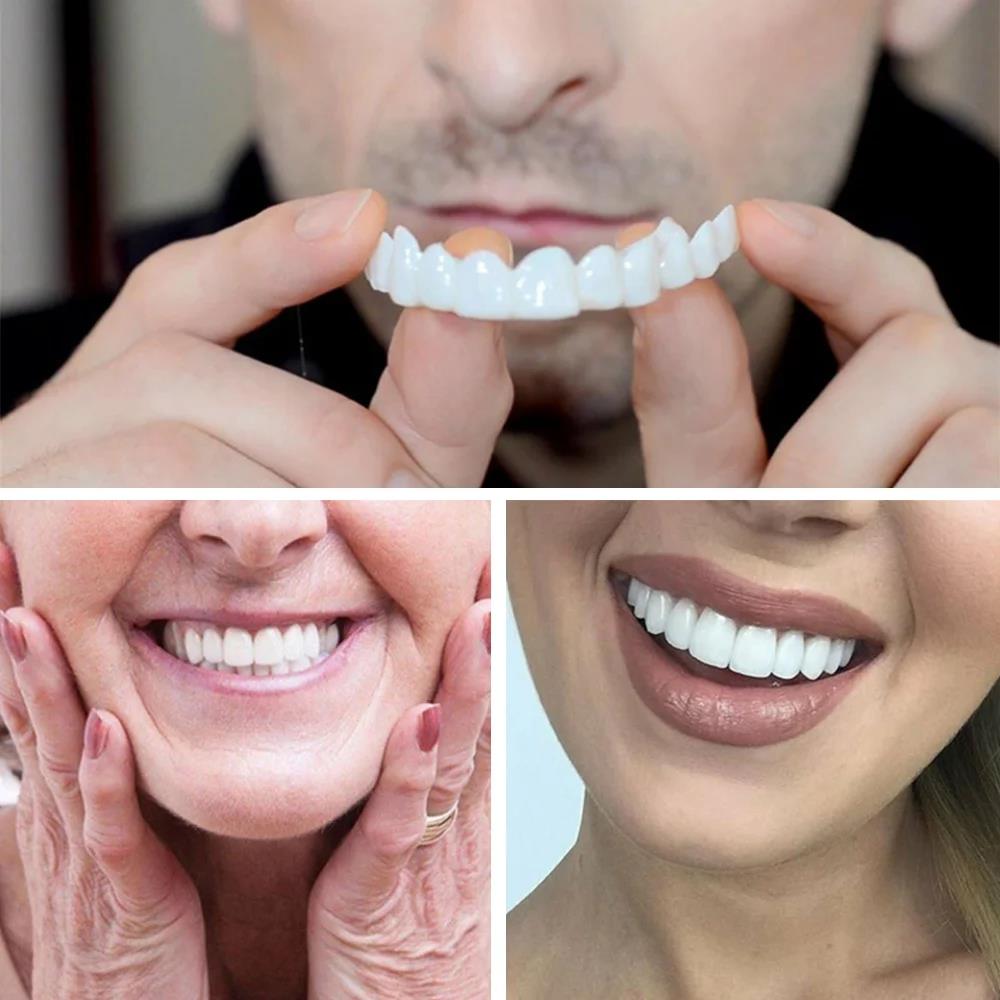 New KOL Influencer Teeth Venee - Teeth Whitening Video recensie en prijs