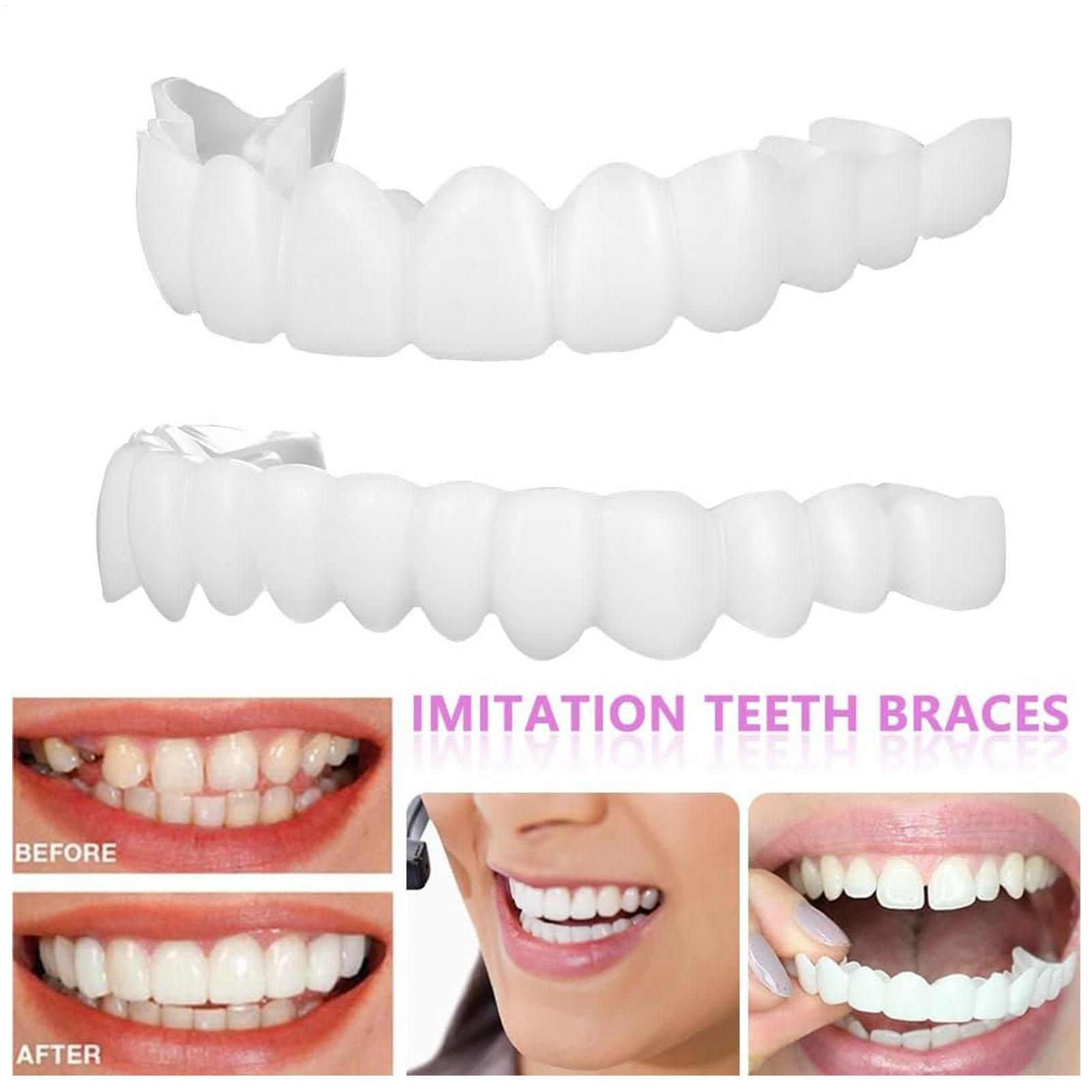 Dental Upper Lower Fake Teeth  - Teeth Whitening With Braces recensie en prijs