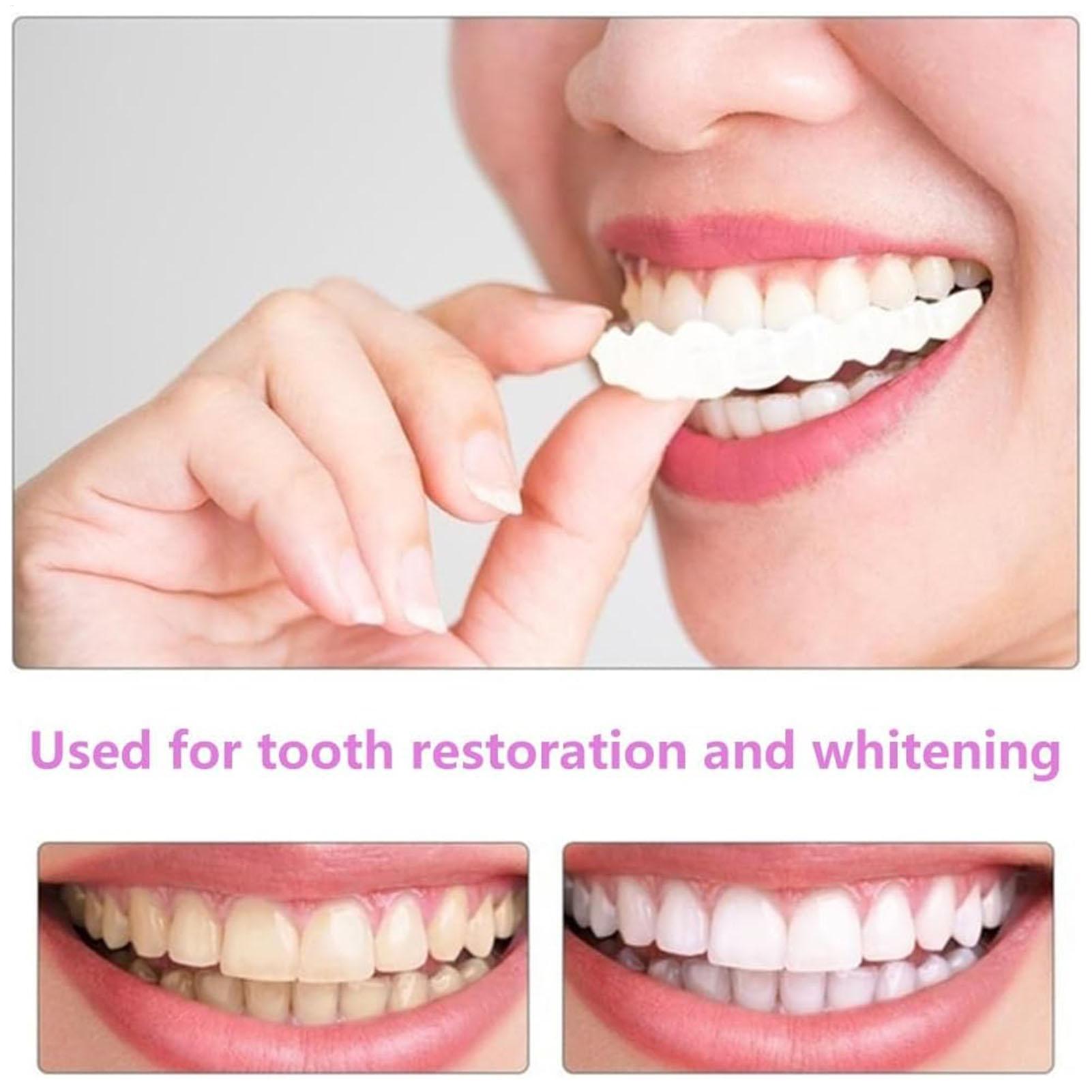Dental Upper Lower Fake Teeth  - Teeth Whitening With Braces recensie en prijs