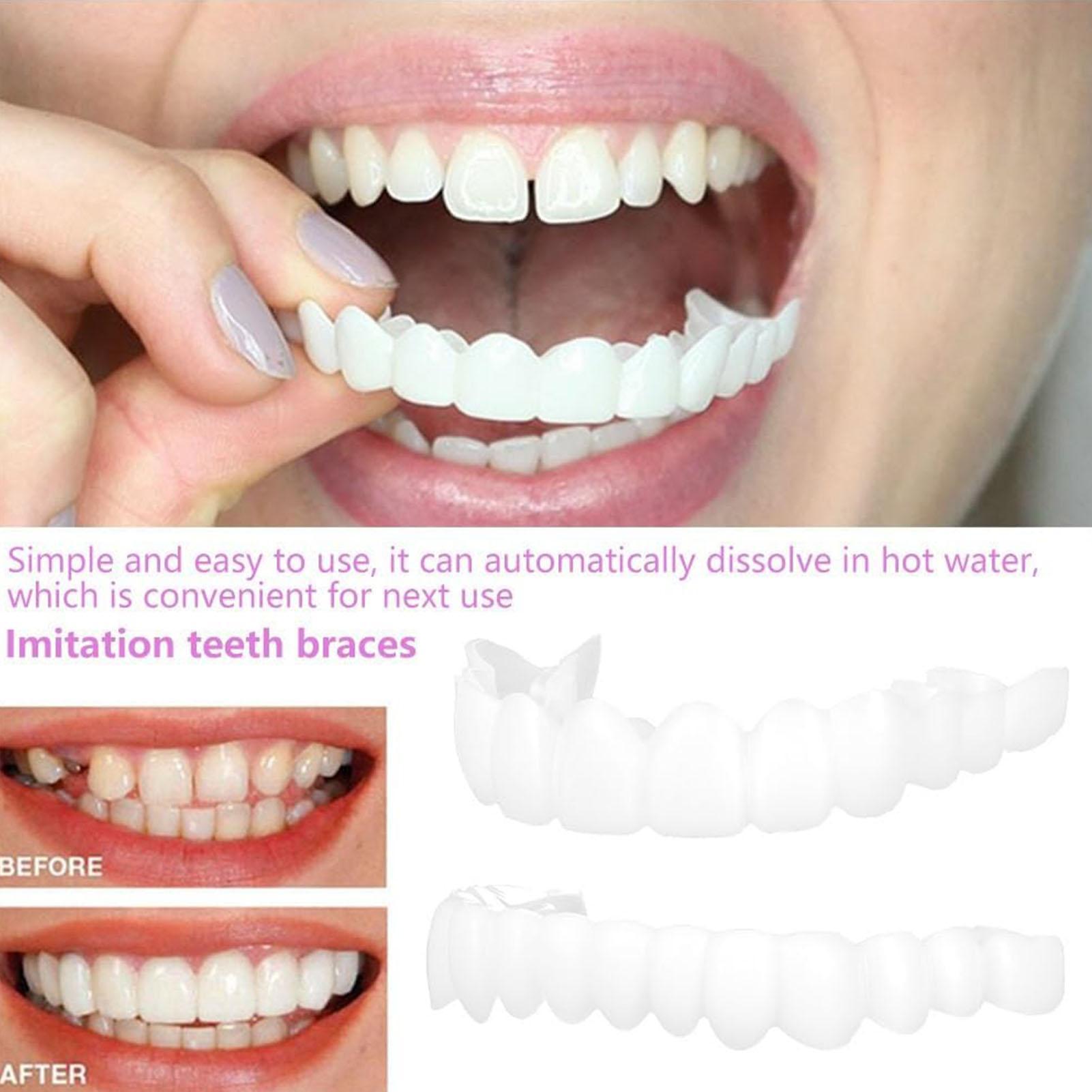 Dental Upper Lower Fake Teeth  - Teeth Whitening With Braces recensie en prijs