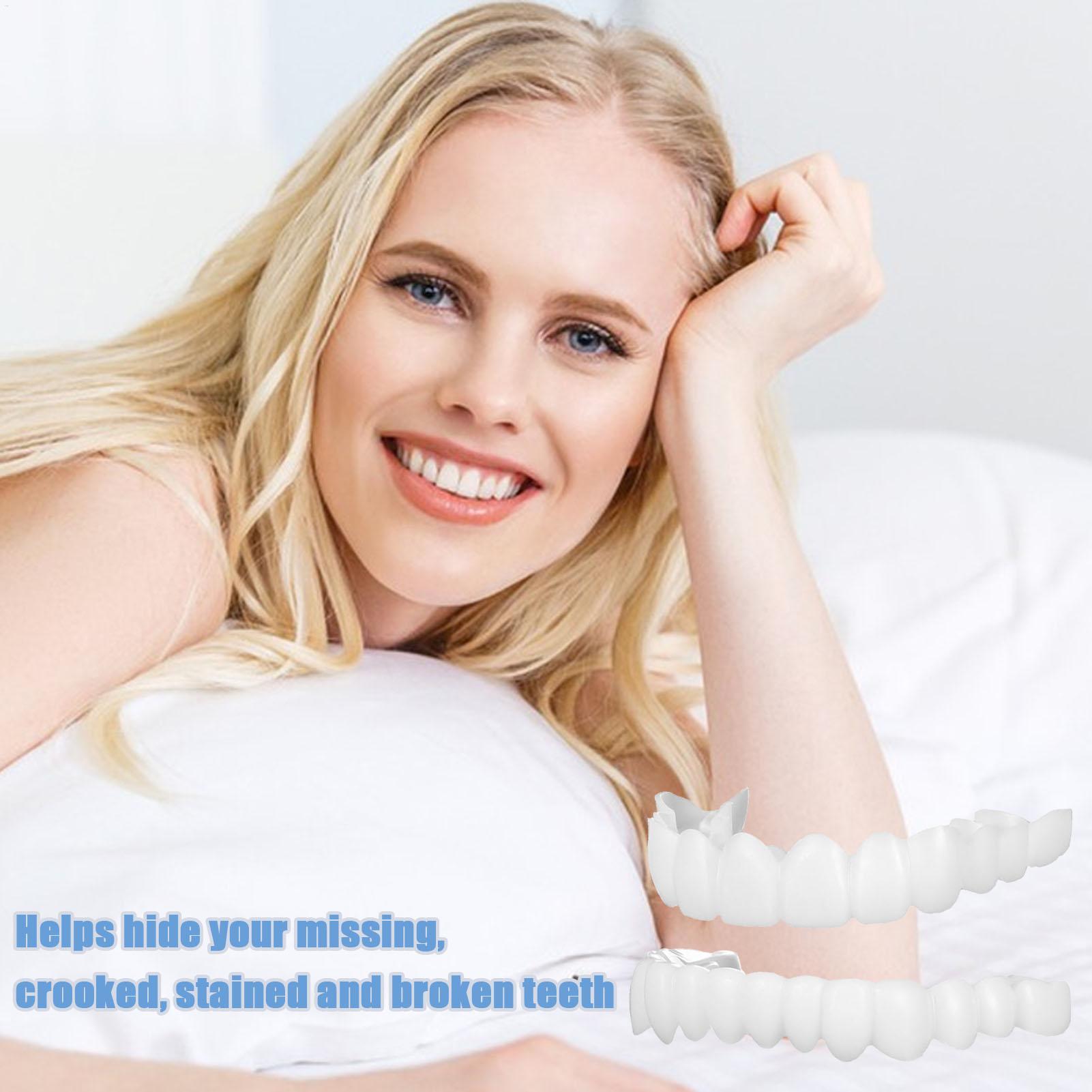 Dental Upper Lower Fake Teeth  - Teeth Whitening With Braces recensie en prijs