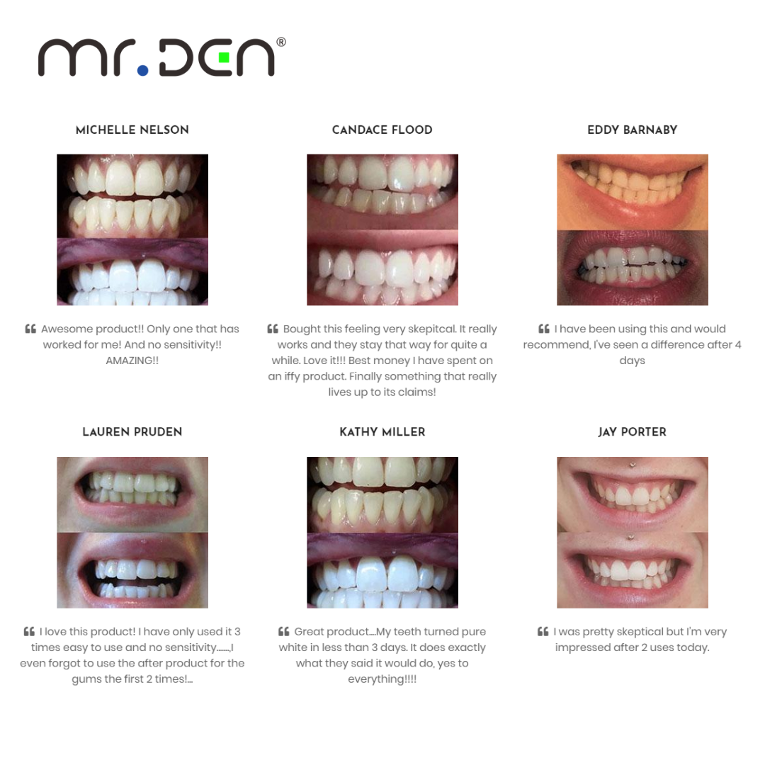 Dr. Whiten 3 Pack Teeth Whiten - Teeth Whitening Light Kit recensie en prijs