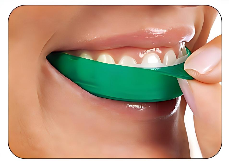 Ultradent Opalescence Go Teeth - Teeth Whitening Opalescence Go recensie en prijs