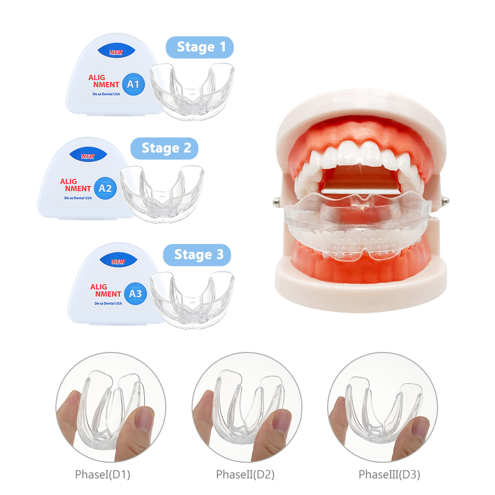 Dental Orthodontic Braces Set  - Teeth Whitening With Braces recensie en prijs