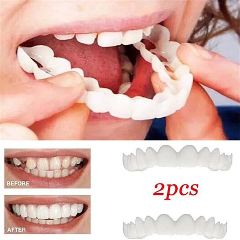 Video Shooting Special Teeth V - Teeth Whitening Video recensie en prijs