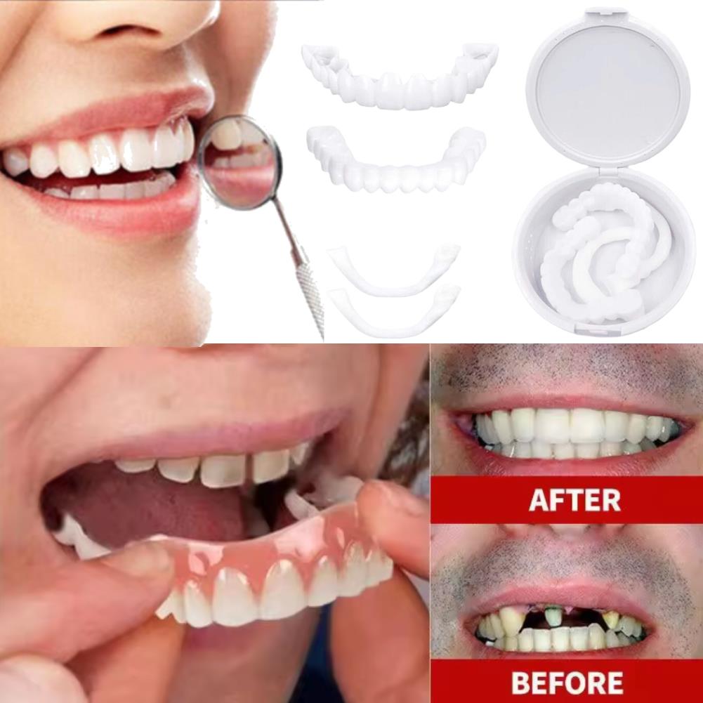 New KOL Influencer Teeth Venee - Teeth Whitening Video recensie en prijs