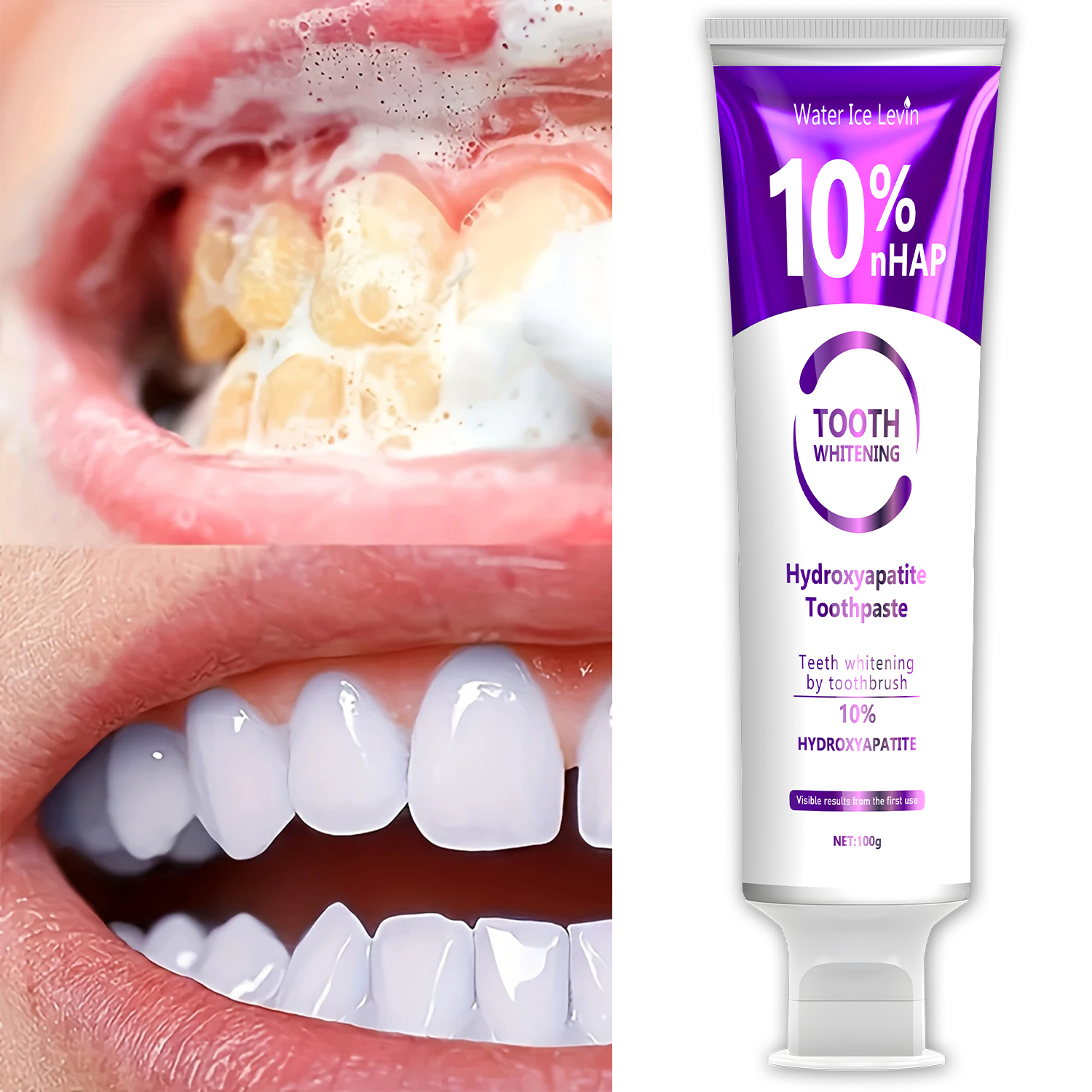 10% Nanoh Hydrogen Oxide Tooth - Teeth Whitening With Peroxide recensie en prijs