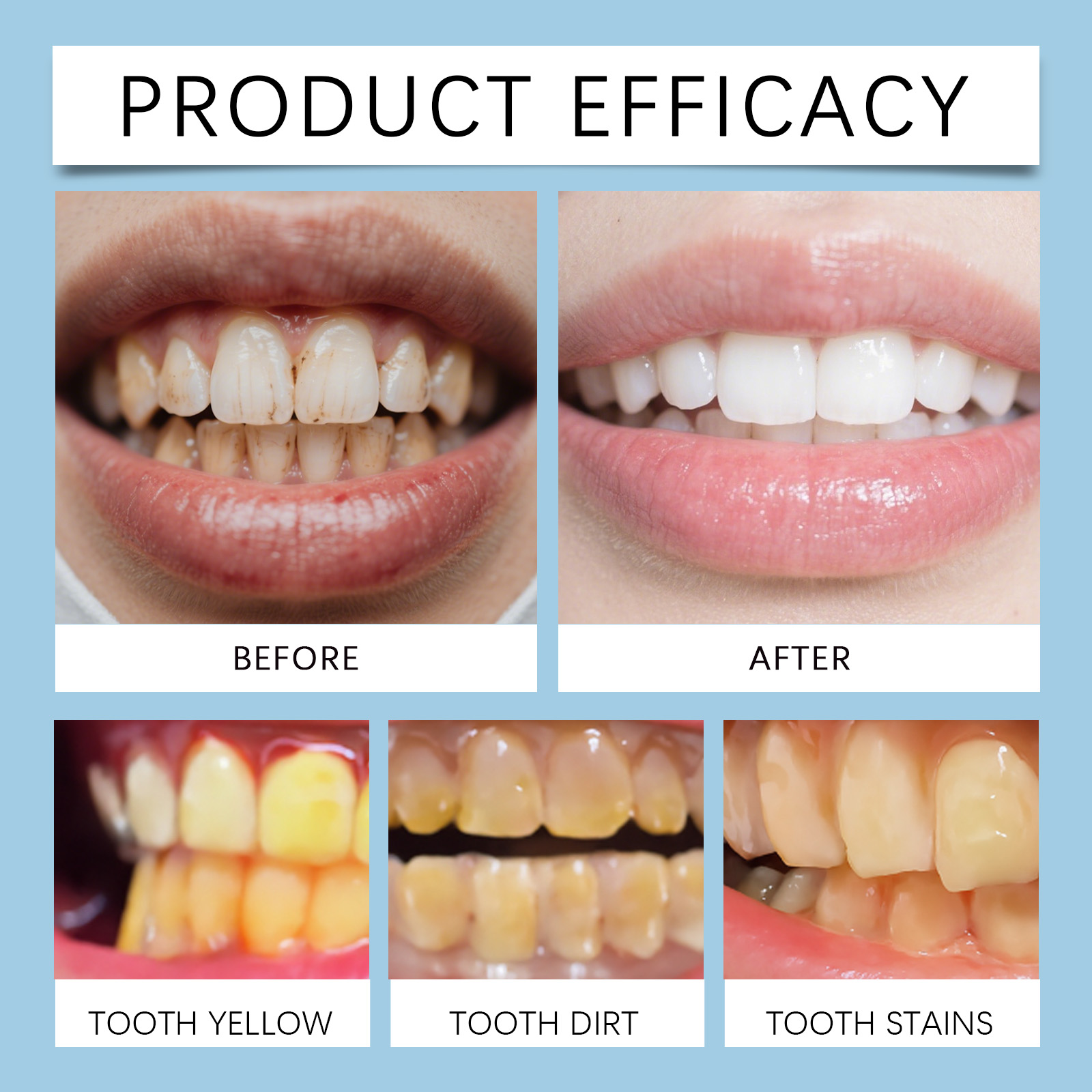 Feimuko 8ml Teeth Gel Pen Gent - Teeth Whitening Doctor recensie en prijs