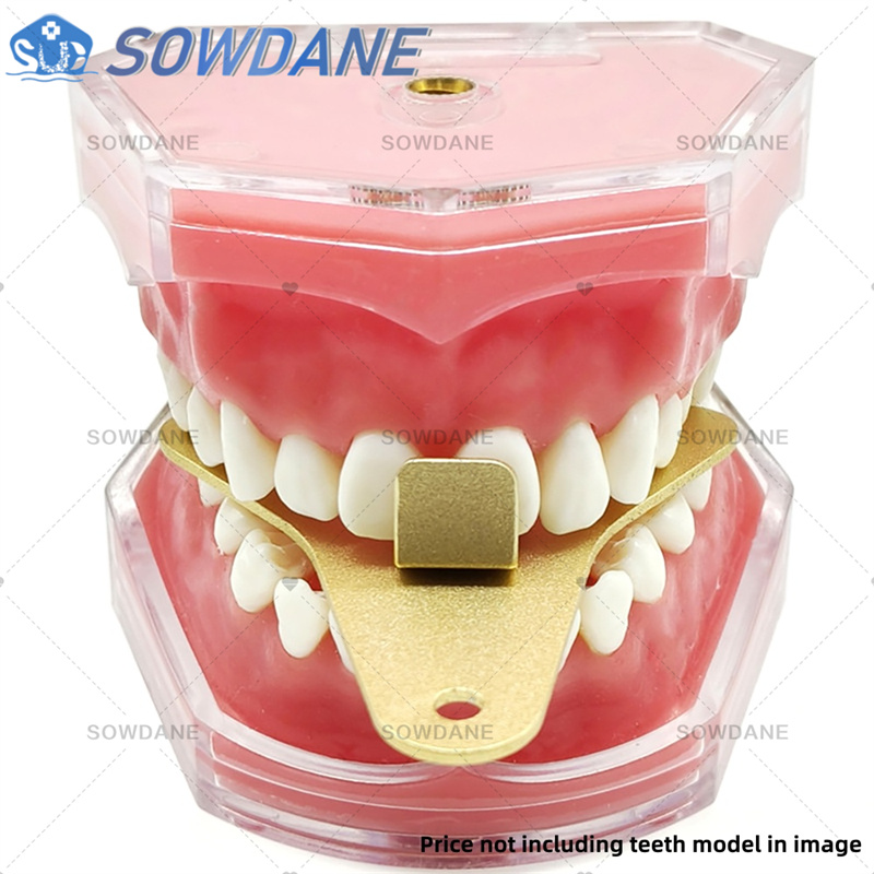 Dental Lab Impression Trays to - Teeth Whitening Tray recensie en prijs