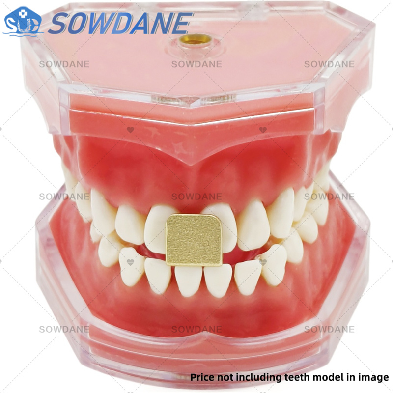Dental Lab Impression Trays to - Teeth Whitening Tray recensie en prijs