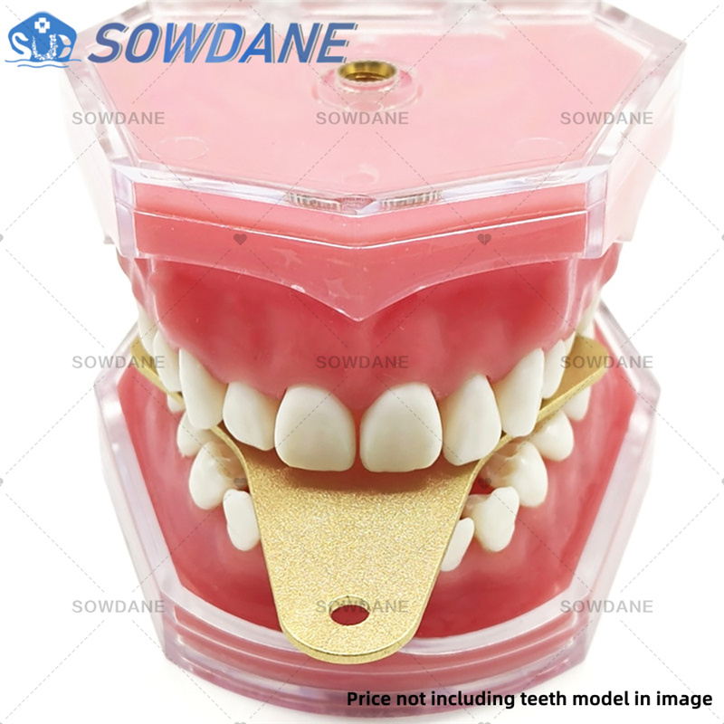 Dental Lab Impression Trays to - Teeth Whitening Tray recensie en prijs