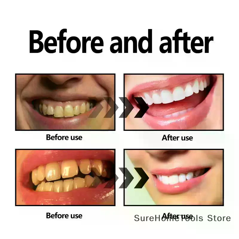Bamboo Charcoal Powder For Tee - Teeth Whitening Co recensie en prijs