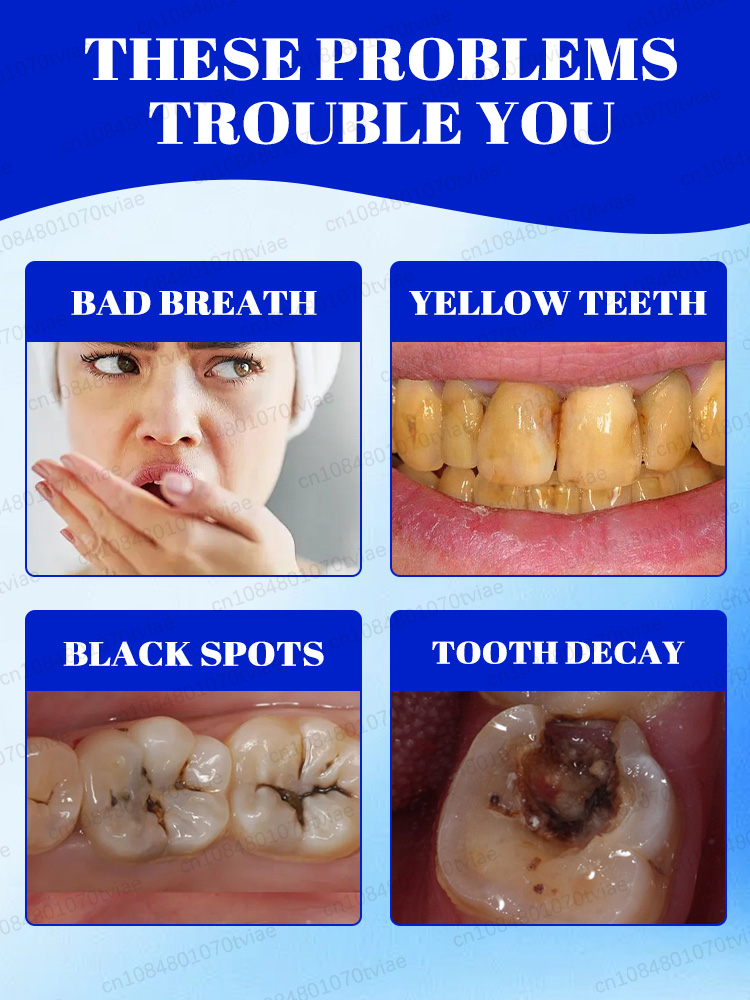 Whitening toothpaste and miner - Teeth Whitening Effects recensie en prijs