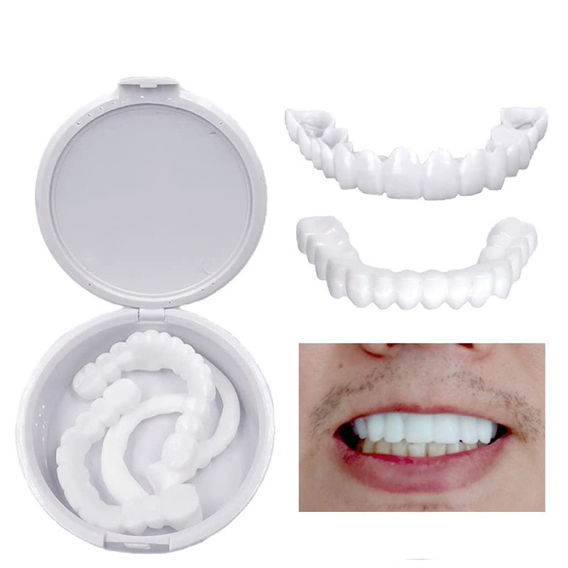 Hot Teeth Veneers Whitening De - Teeth Whitening With Braces recensie en prijs