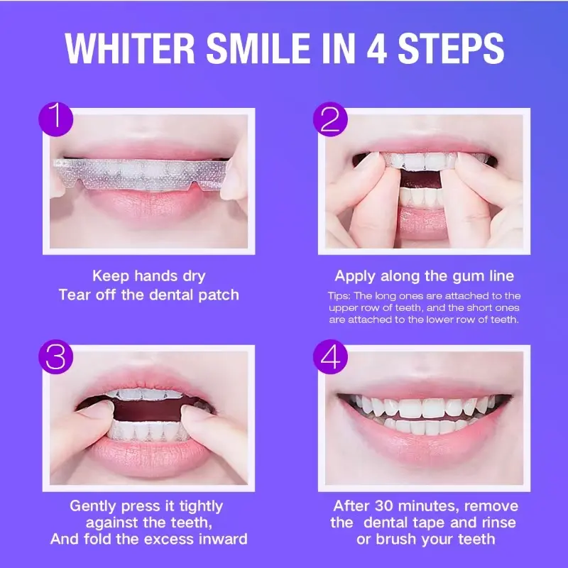 Teeth Whitening Kit - 5X LED L - Teeth Whitening Clinic recensie en prijs