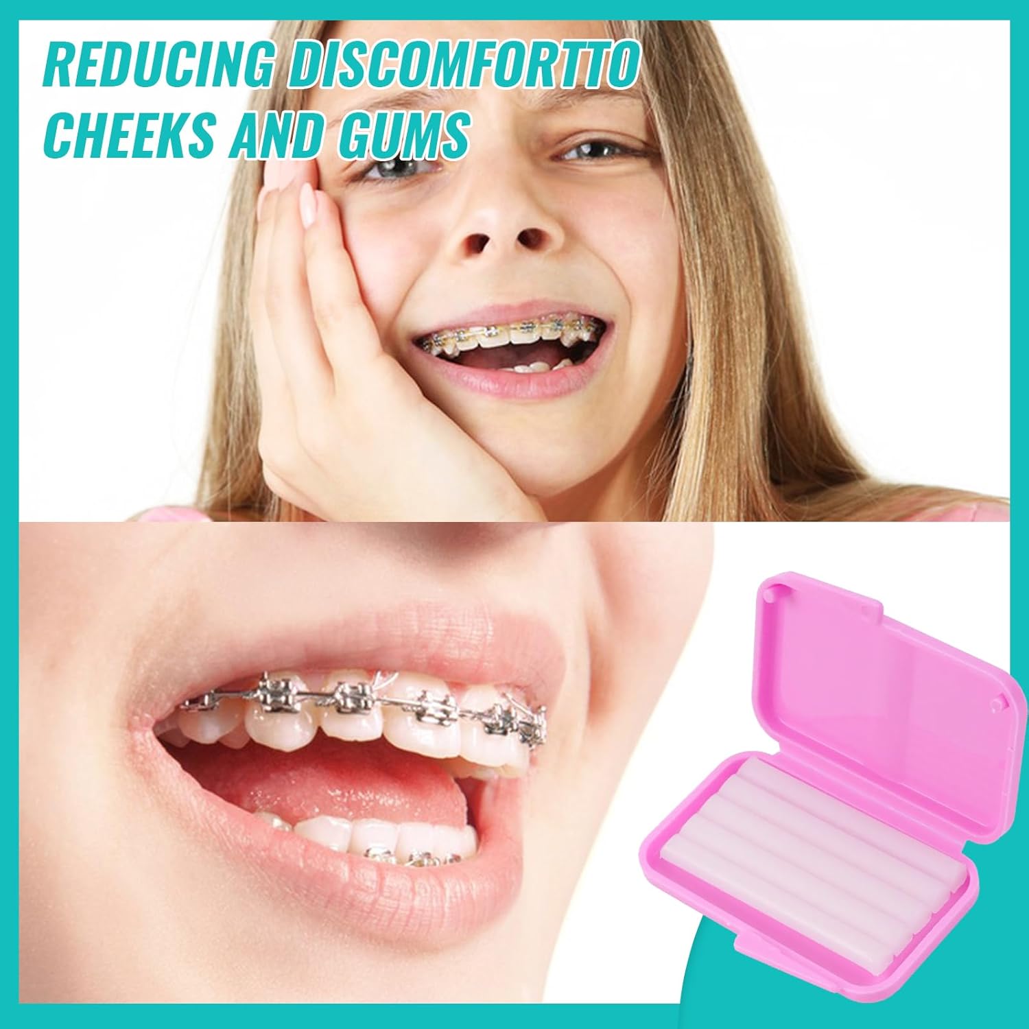 10box Dental Orthodontic Relie - Teeth Whitening With Braces recensie en prijs