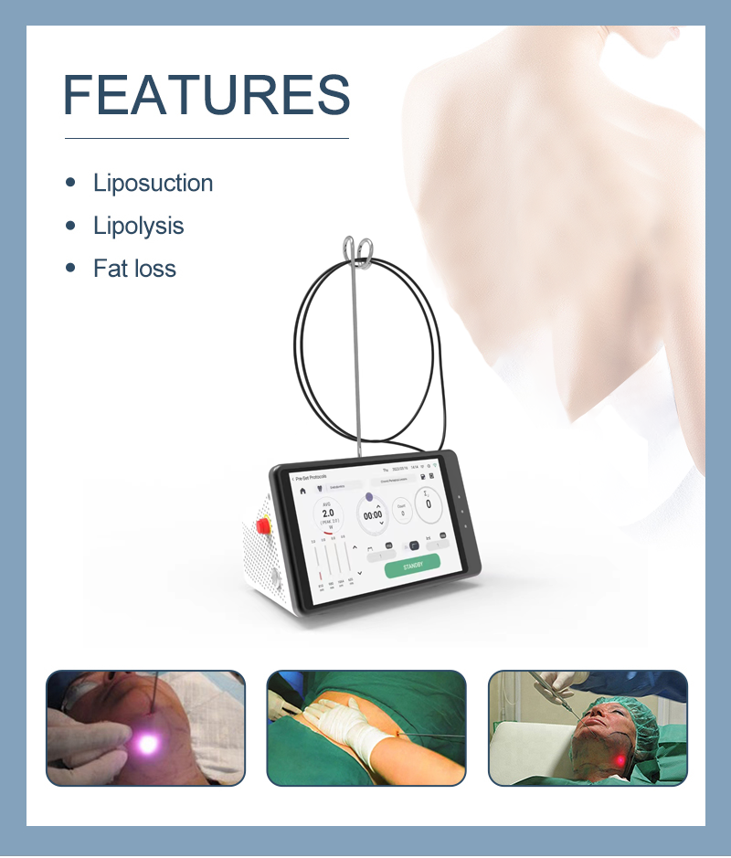 Dental Laser Teeth Whitening D - Teeth Whitening Clinic recensie en prijs