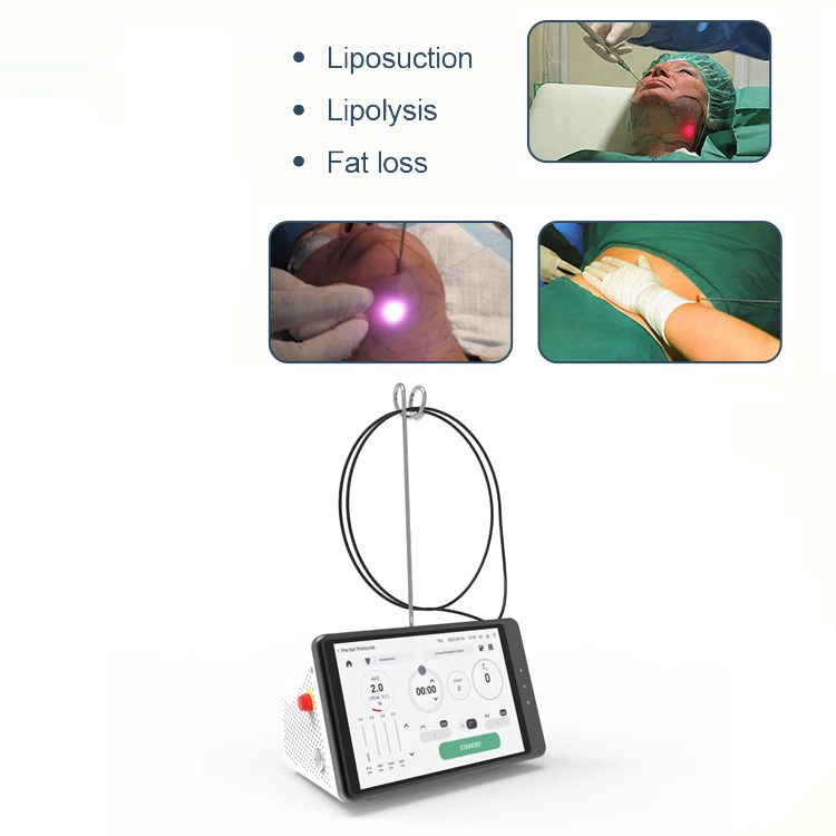 Dental Laser Teeth Whitening D - Teeth Whitening Clinic recensie en prijs