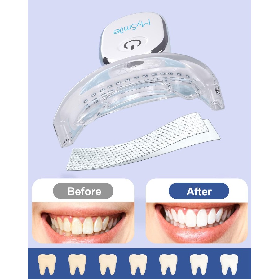 Teeth Whitening Strips Kit wit - Teeth Whitening Light Kit recensie en prijs