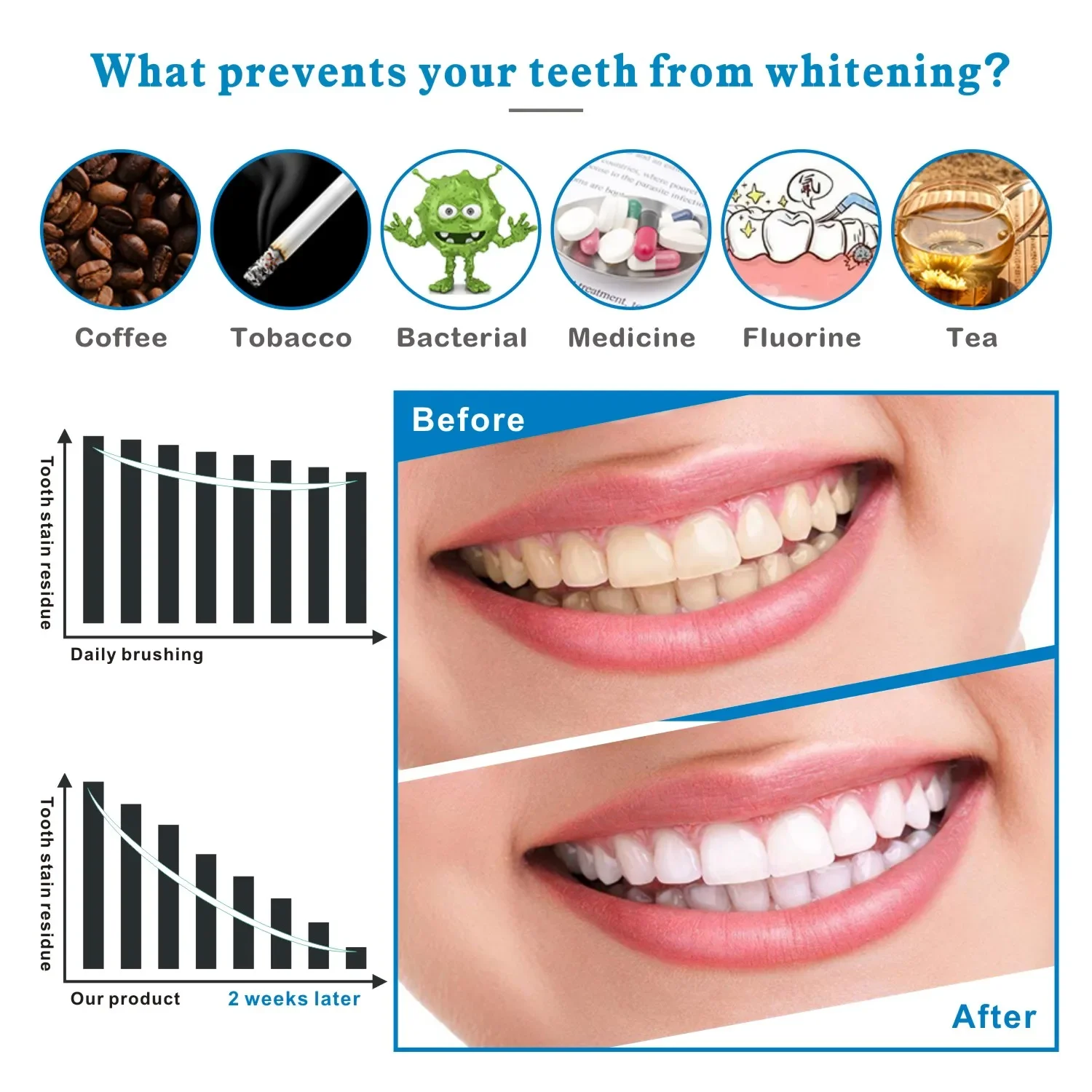 14/28pcs 3D Teeth Whitening St - Teeth Whitening Effects recensie en prijs