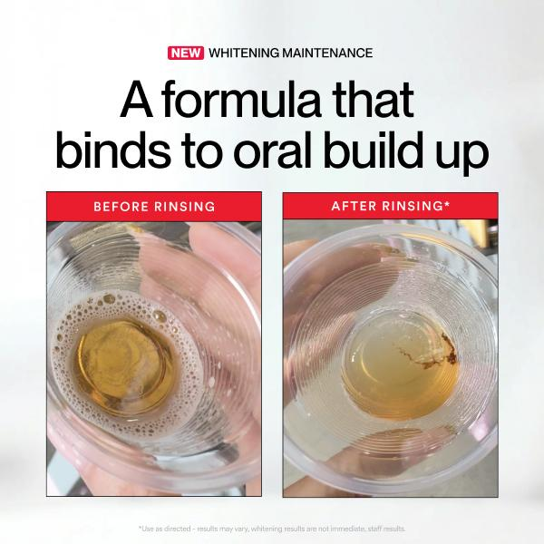 Hismile ID Whitening Stain Mou - Teeth Whitening With Peroxide recensie en prijs