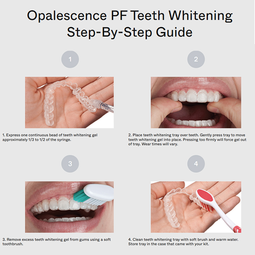 opalescence pf 15% refill kit  - Teeth Whitening Gel Opalescence recensie en prijs