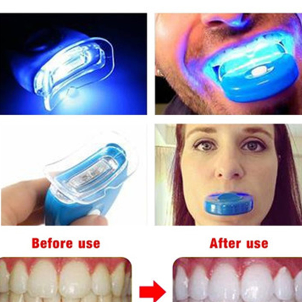 New Blue Led Teeth Whitening A - Teeth Whitening Video recensie en prijs