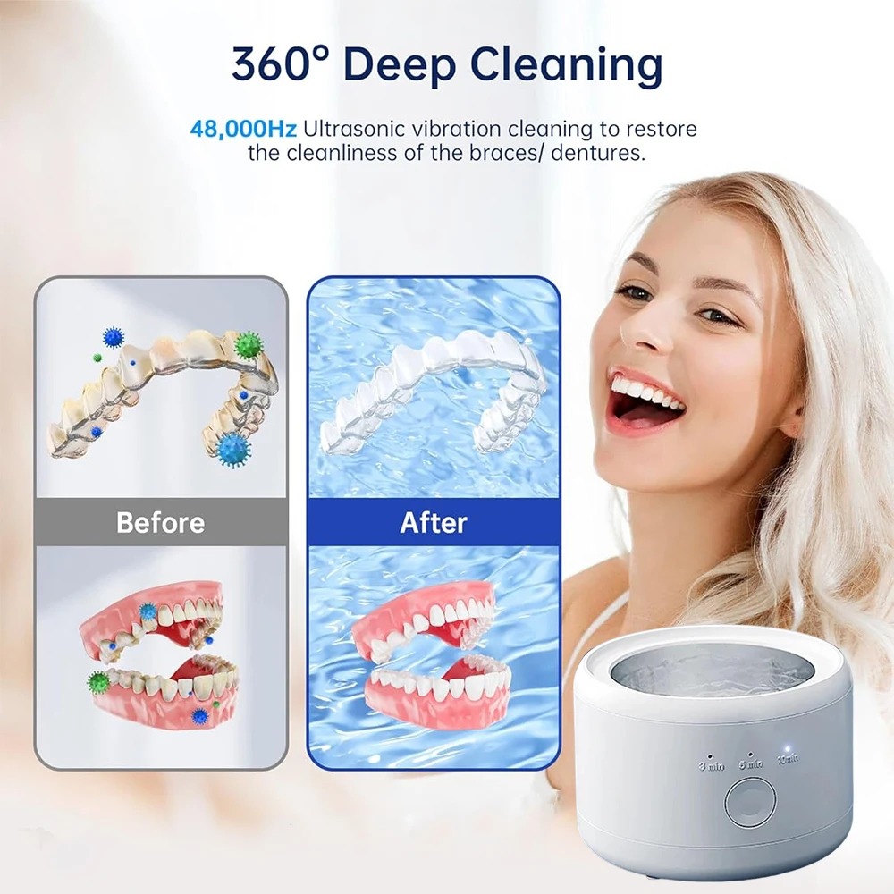 USB Powered Dental Appliance C - Teeth Whitening With Braces recensie en prijs