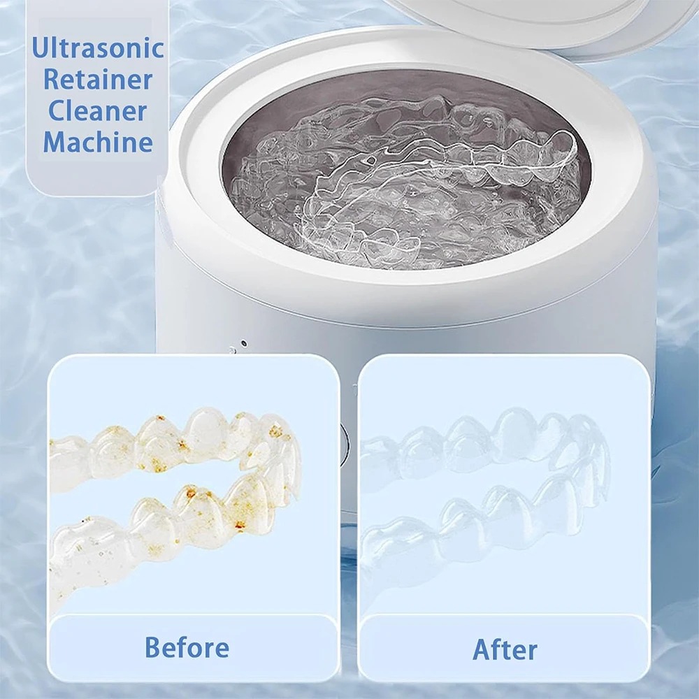 USB Powered Dental Appliance C - Teeth Whitening With Braces recensie en prijs