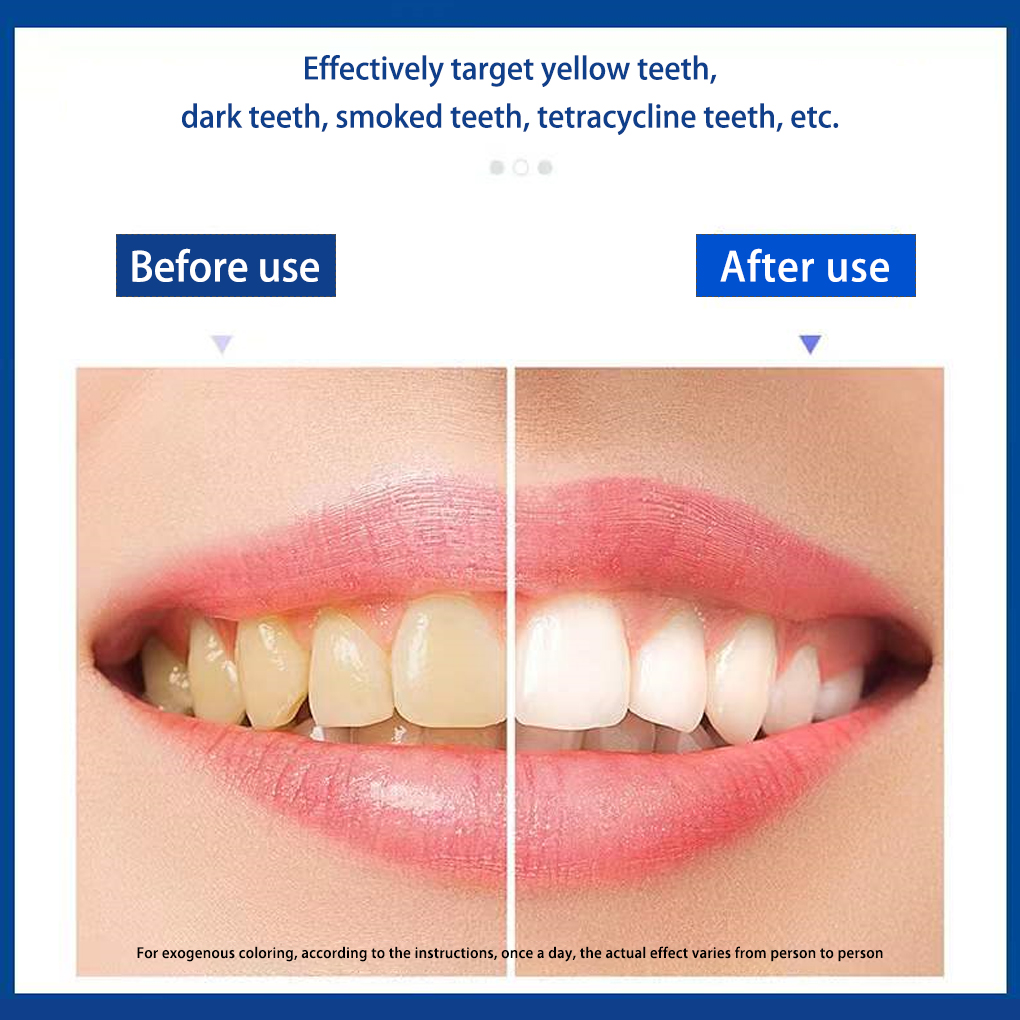 70/140 Pairs 5D White Teeth Wh - Teeth Whitening Effects recensie en prijs
