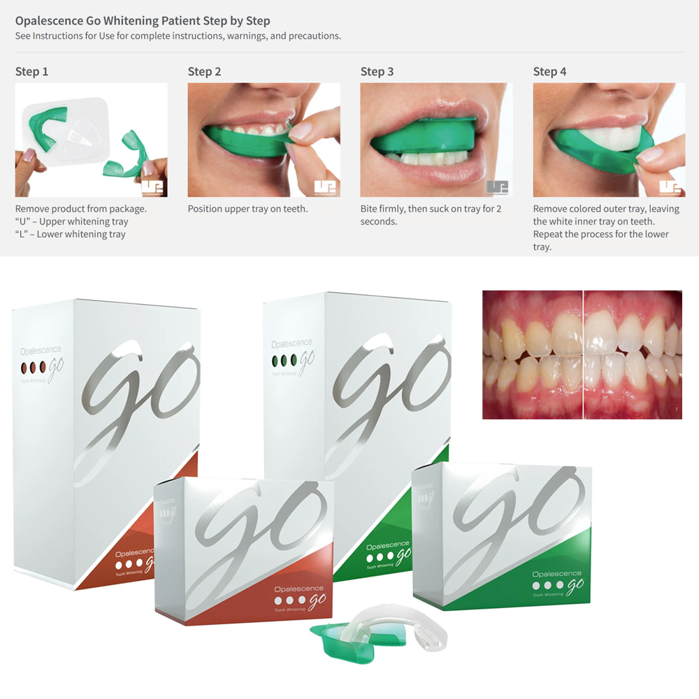 Opalescence Go Teeth Whitening - Teeth Whitening Gel Opalescence recensie en prijs