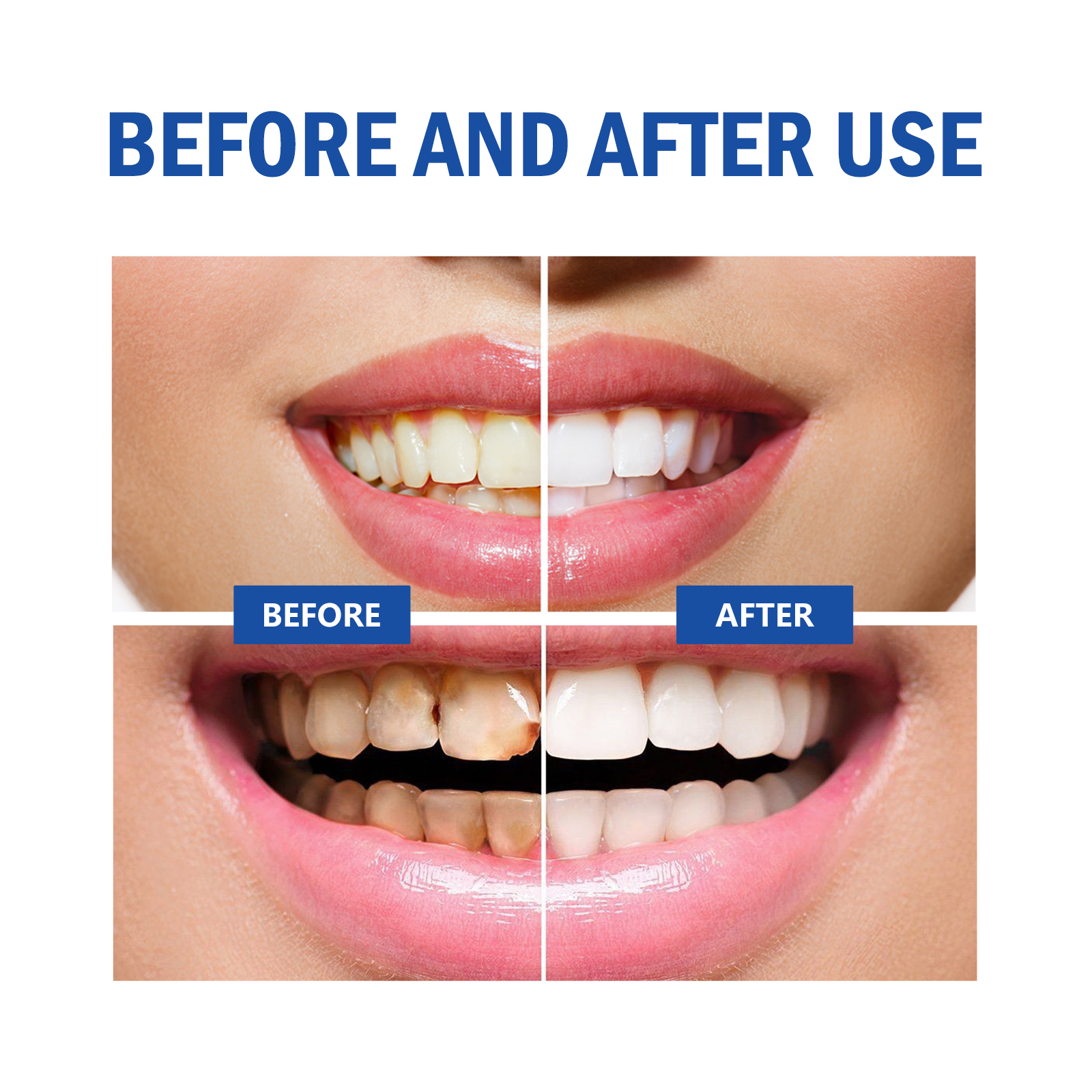 Teeth Whitening Powder Remove  - Teeth Whitening Xylitol Gum recensie en prijs