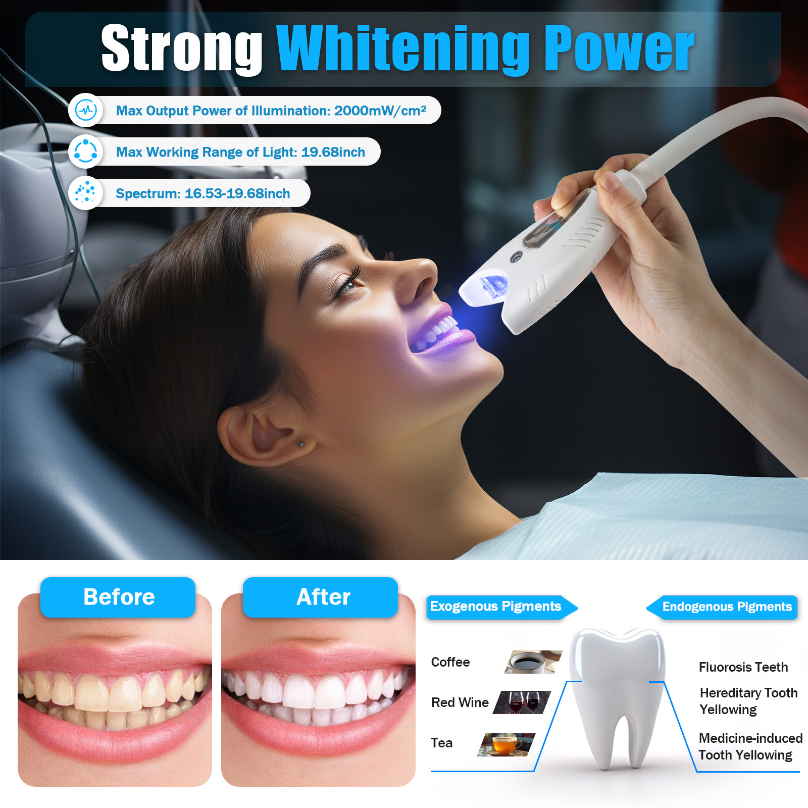 Mobile Dental Teeth Whitening  - Teeth Whitening Video recensie en prijs