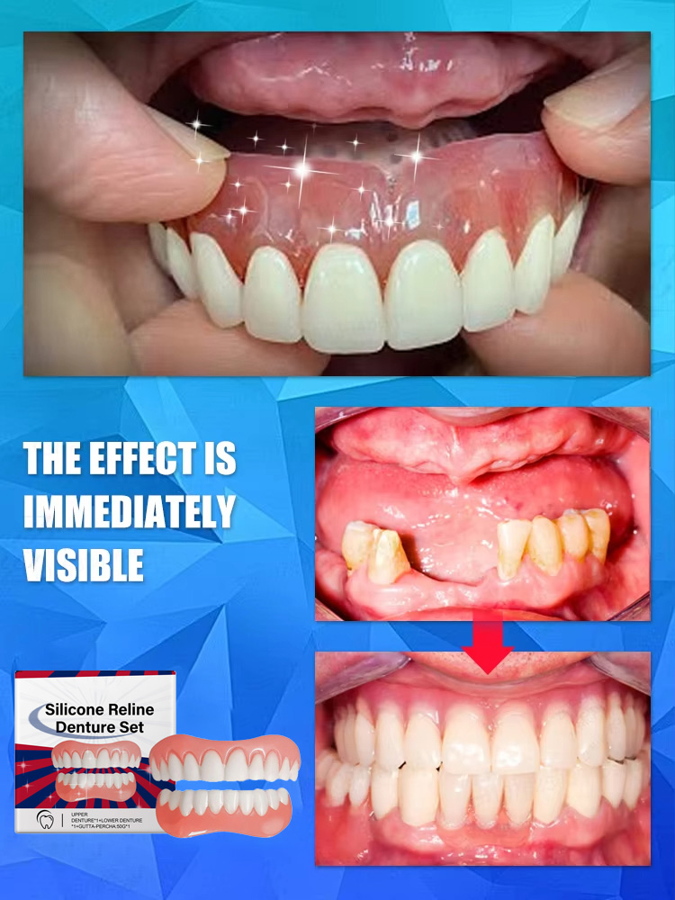 False Teeth Silicone Upper Low - Teeth Whitening With Braces recensie en prijs