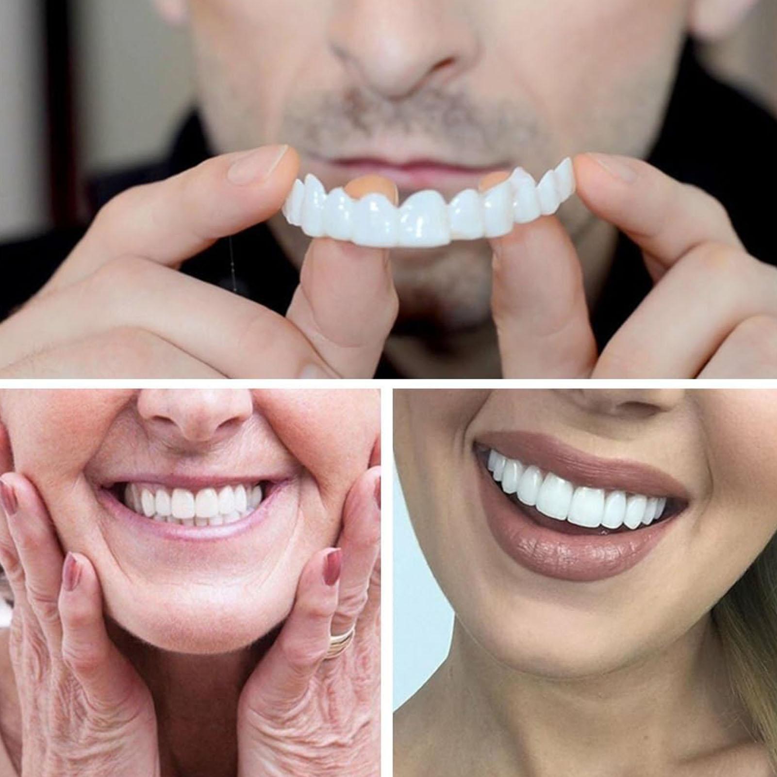 Camera Shy Person Teeth Veneer - Teeth Whitening Video recensie en prijs