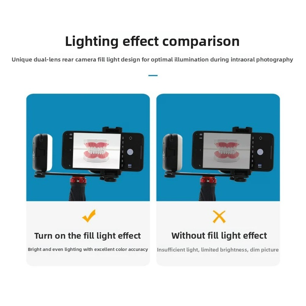 Dental Photography Light, Blue - Teeth Whitening Light Kit recensie en prijs