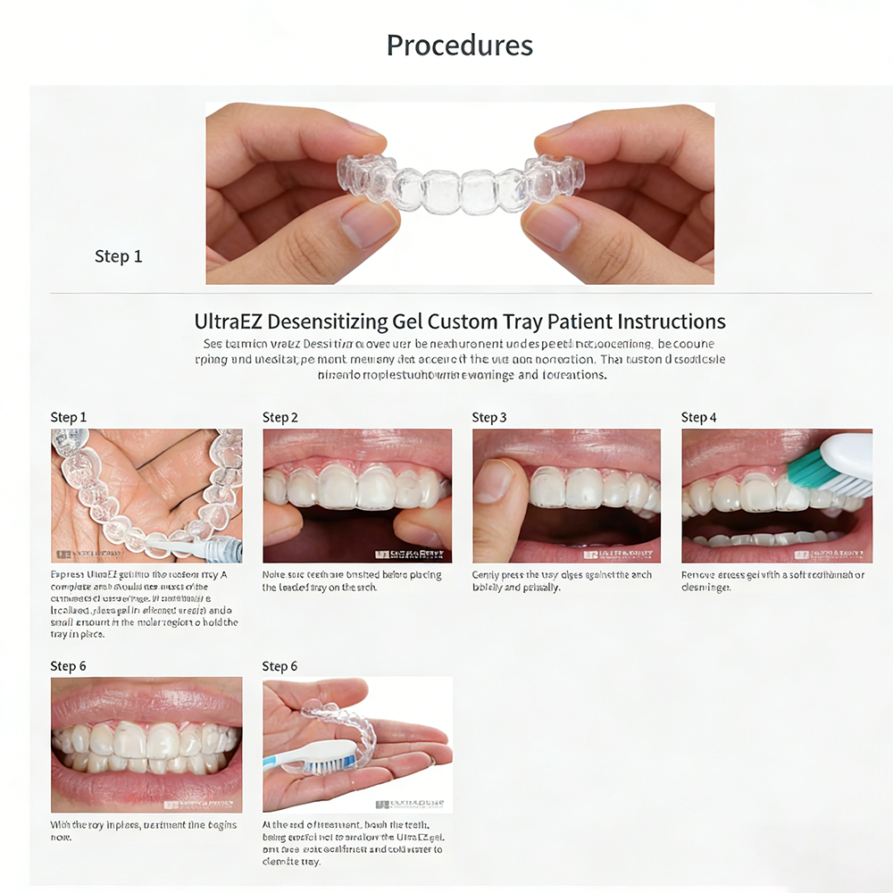 Ultra Ez Dental Desensitizing  - Teeth Whitening Gel Opalescence recensie en prijs