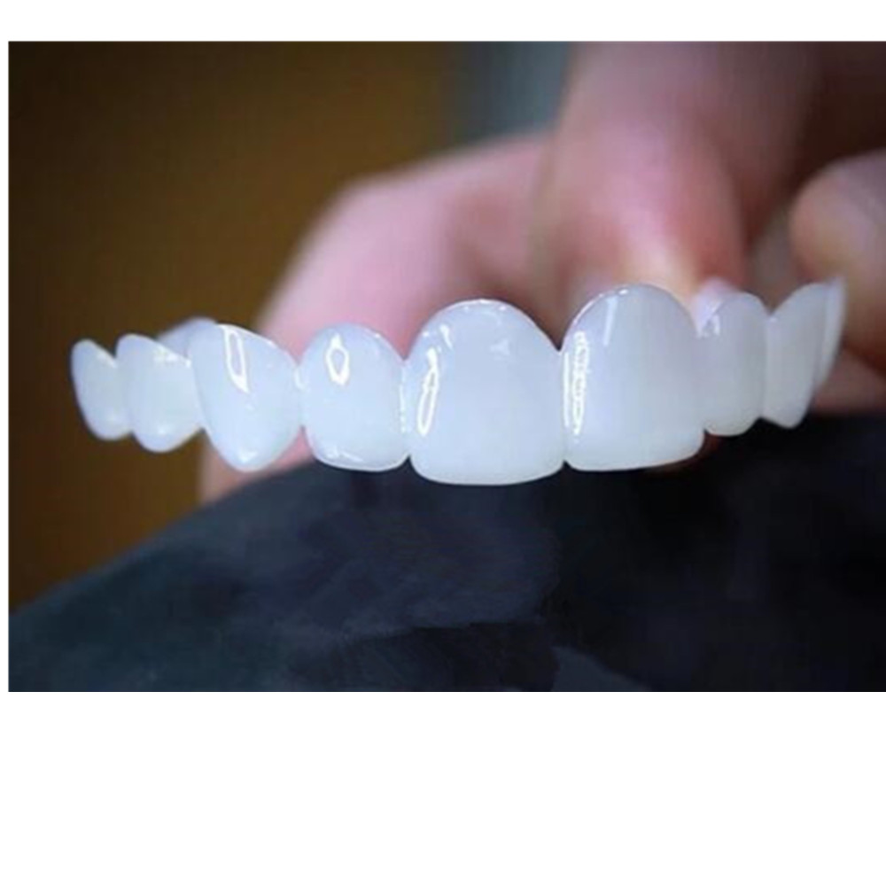 Whitening Teeth Veneers Tempor - Teeth Whitening With Braces recensie en prijs
