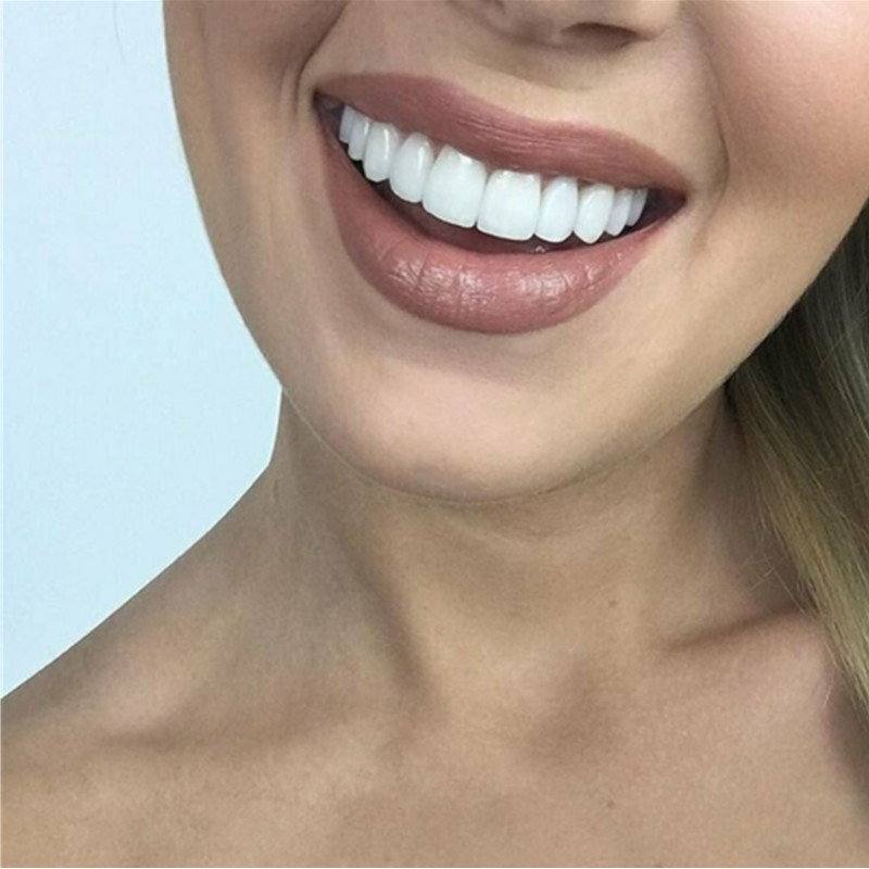 Whitening Teeth Veneers Tempor - Teeth Whitening With Braces recensie en prijs