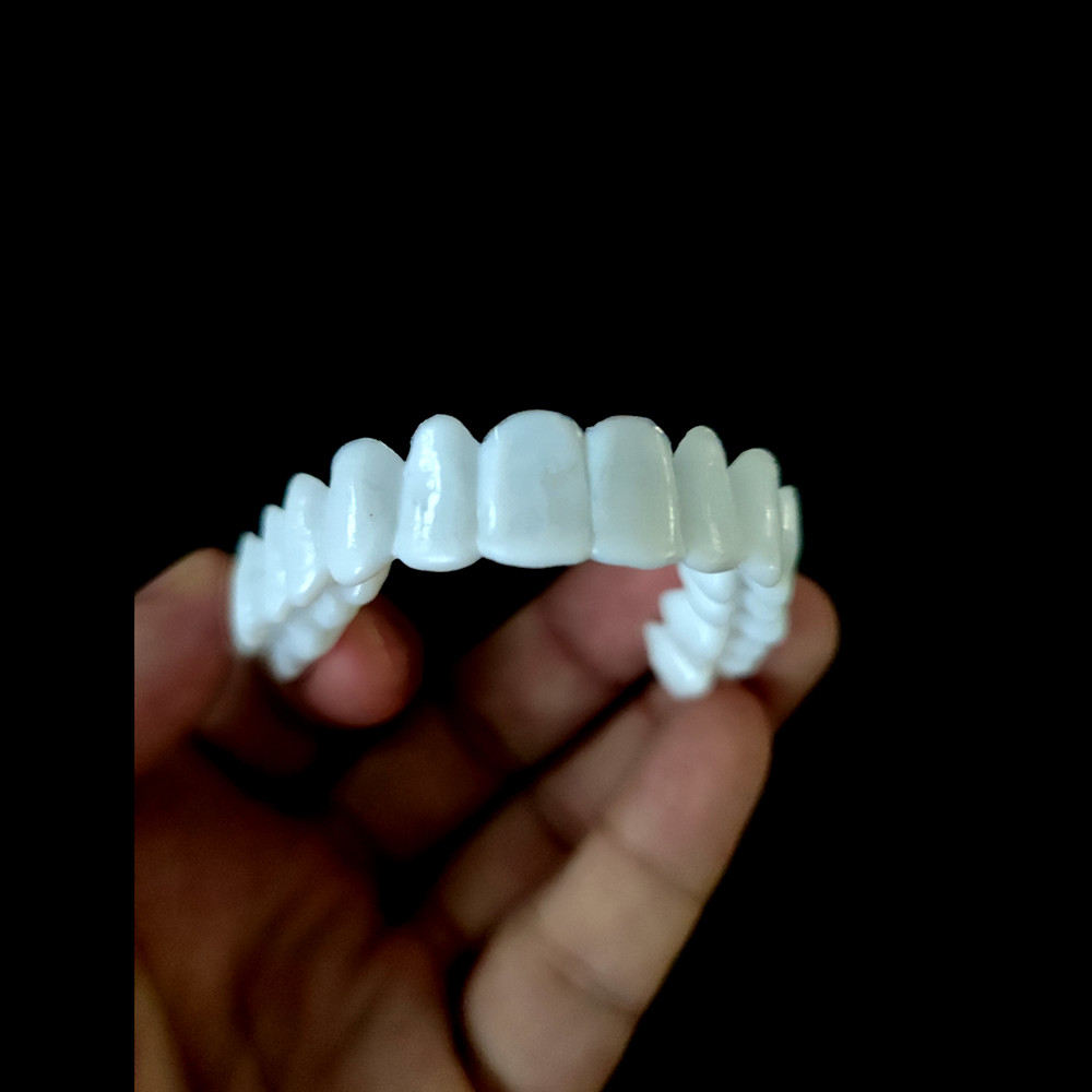 Whitening Teeth Veneers Tempor - Teeth Whitening With Braces recensie en prijs
