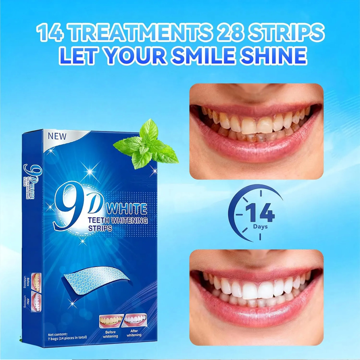 Teeth Whitening Strips - 9D Te - Teeth Whitening Effects recensie en prijs