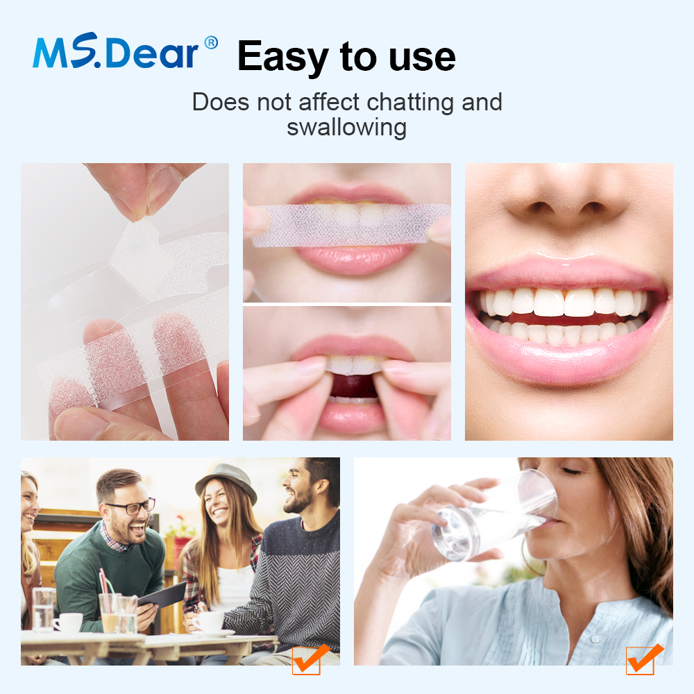 Teeth Whitening Strips Cleansi - Teeth Whitening Clinic recensie en prijs